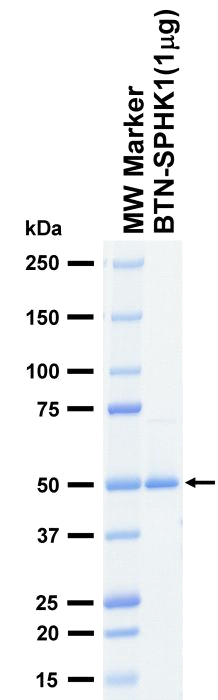 The purity was assessed by SDS-PAGE/CBB staining.
